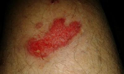 post-6671-0-43971000-1434533570_thumb.jp